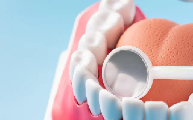 虫歯・歯周病のリスクを軽減